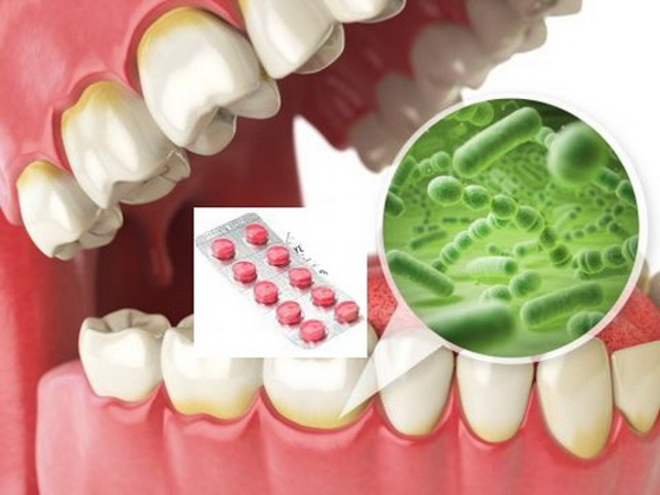 Dùng thuốc chống nhiễm khuẩn răng miệng hiệu quả