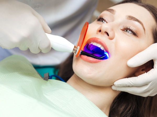 Tẩy trắng răng tại nha khoa bằng gel