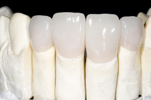 2 loại răng sứ zirconia phổ biến ngày nay