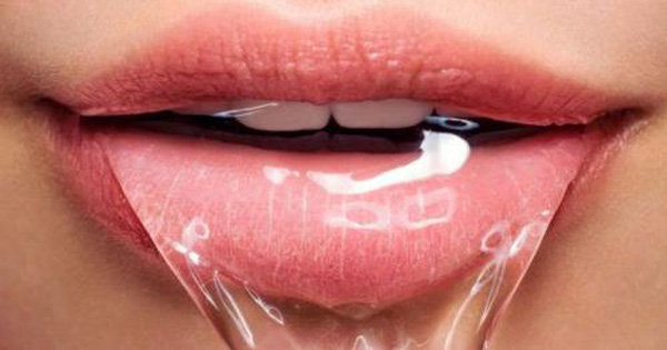 Miệng tiết nhiều nước bọt gây cảm giác bất tiện và không thoải mái cho người bệnh