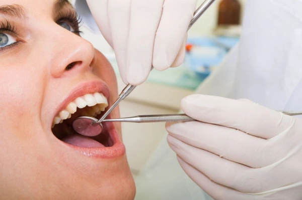 Chỉnh nha răng là một phương pháp hiệu quả giải quyết vấn đề răng khôn mọc lệch 45 độ