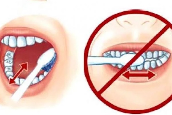 Hậu quả đánh răng sai cách