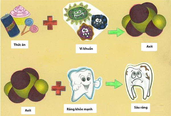 Nhiều yếu tố hàng ngày gây sâu răng