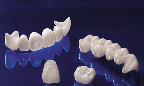 Răng toàn sứ là loại răng giả với chất liệu sứ cao cấp