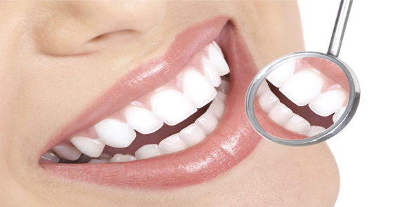 Chi phí trồng răng phụ thuộc vào nhiều yếu tố như loại răng giả, vị trí cấy ghép