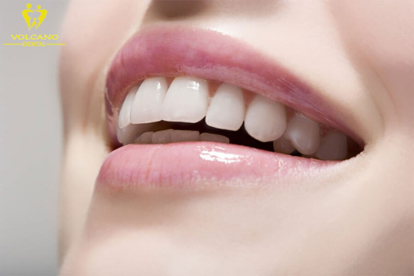 Răng gãy trong khi chân răng vẫn còn khỏe mạnh, phương pháp bọc răng sứ thẩm mỹ là một giải pháp hiệu quả