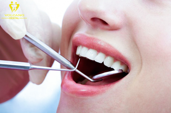 Bác sĩ nha khoa sẽ kiểm tra và đánh giá tình trạng răng miệng của bạn sau quá trình hồi phục răng bị mẻ