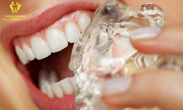 Thói quen nhai đá là một trong những nguyên nhân làm cho răng yếu đi và nứt răng