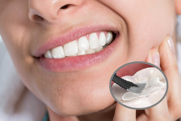 Chỗ trám răng xong bị ê buốt trong bao lâu hết? Chỗ trám răng xong bị ê buốt trong bao lâu hết?