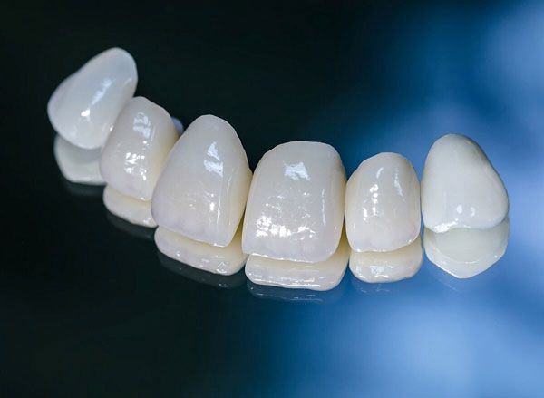 Răng sứ Lava là dòng răng được ứng dụng công nghệ Nano hiện đại