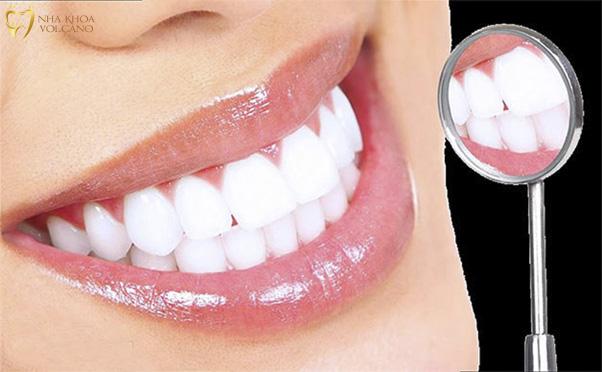 Việc quyết định tần suất tẩy trắng răng là một quyết định quan trọng để duy trì nụ cười tự tin