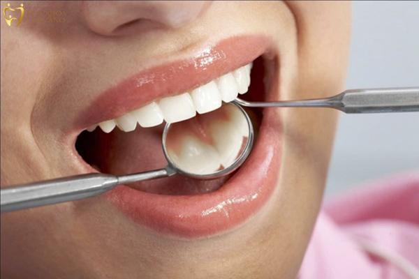 Nhổ nước bọt ra máu: Khi nào cần thăm bác sĩ? Kiểm tra và điều trị cavities kịp thời là một phần quan trọng của chăm sóc răng miệng