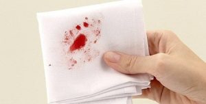 Nhổ nước bọt ra máu: Khi nào cần thăm bác sĩ?