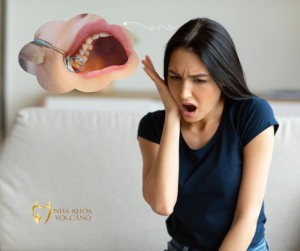Răng khôn mọc lệch