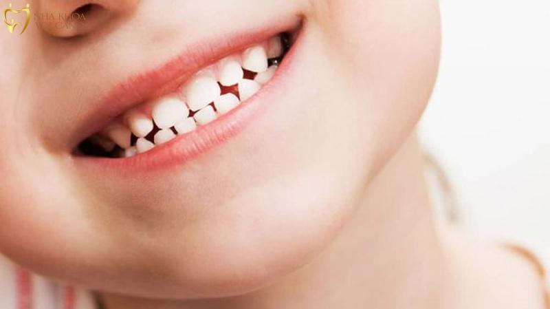 Thời gian mọc của răng sữa