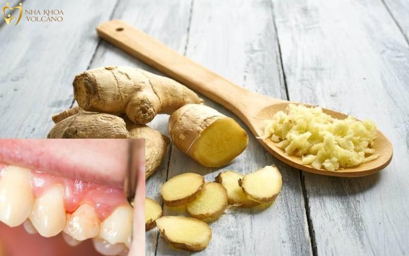 Sử dụng gừng tươi điều trị viêm chân răng có mủ
