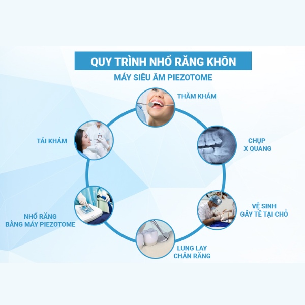 Chi phí nhổ răng khôn là bao nhiêu? Giải đáp chi tiết tại Nha khoa Quốc tế Volcano Dĩ An Trám răng khôn