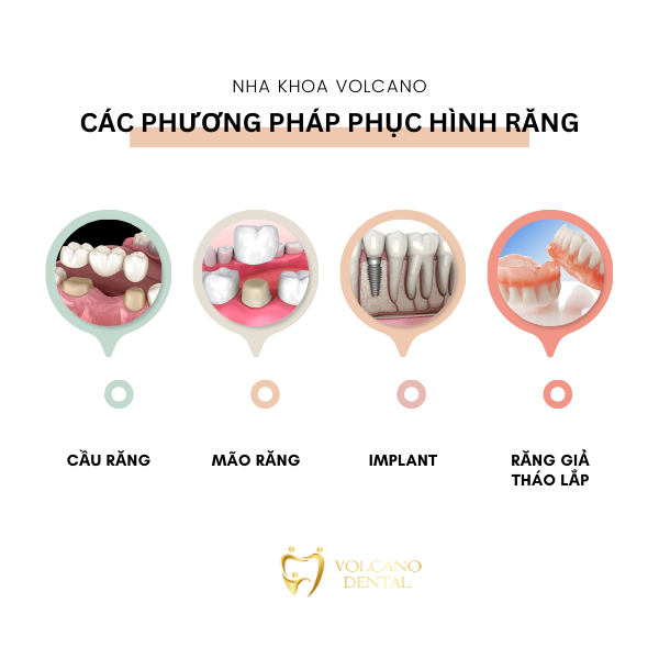 Phục hình răng