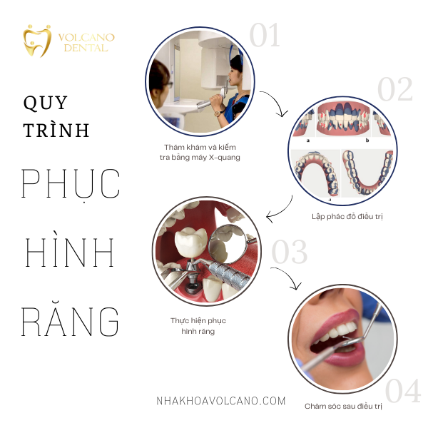 Phục hình răng