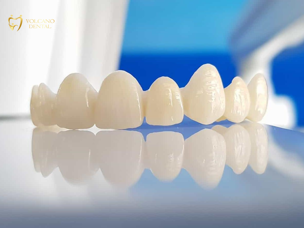 Bọc răng sứ
